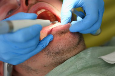 Mavi koruyucu eldiven El