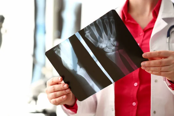 Vrouwelijke radioloog Hold in de hand Xray film — Stockfoto