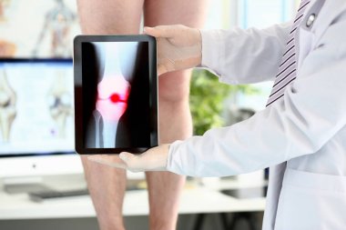 Erkek hekim elleri boyama alanı ile xray çekim gösteren tablet bilgisayar tutan