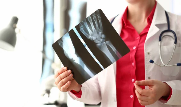 Vrouw arts houden rechter hand bot X-Ray afbeelding — Stockfoto