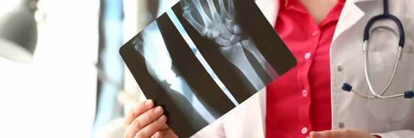 Γυναίκα γιατρός κρατώντας το δεξί χέρι οστική εικόνα ακτίνων χ — Φωτογραφία Αρχείου