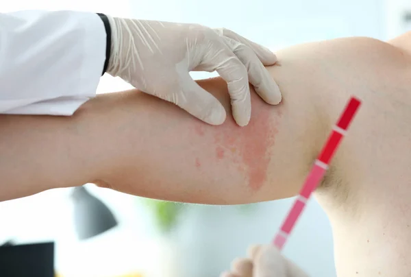 Koncepce testu alergie na farmaceutické léky — Stock fotografie