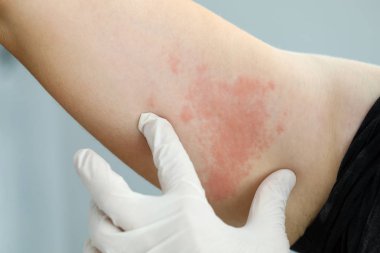 Alerjik acele muayenesi