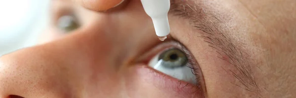 Uomo mettendo gocce liquide nel suo problema di visione risolvere gli occhi — Foto Stock