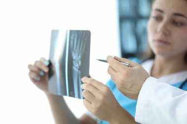 Woman looks at an x-ray hand, next to doctor clipart