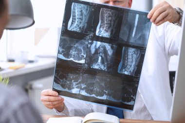 Özenli bir sağlık çalışanı X-ray fotoğrafını kontrol ediyor.