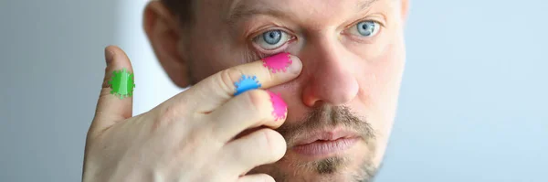 Man scratches his face with a dirty hand near his eye