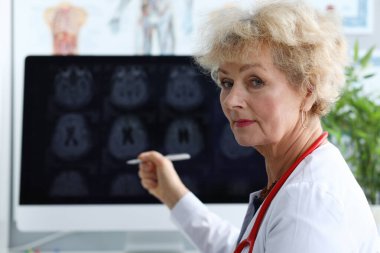 Yaşlı kadın doktor kalemini röntgende gösteriyor.