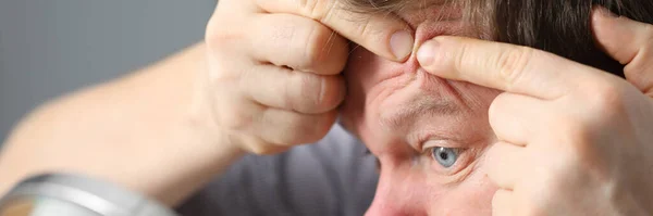 Mannen som tar hand om ansiktet — Stockfoto