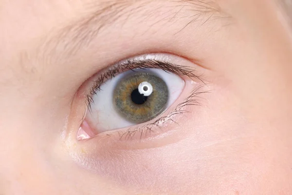 Wide open childs eye with an eyebrow and moles on skin. — Stock Photo, Image