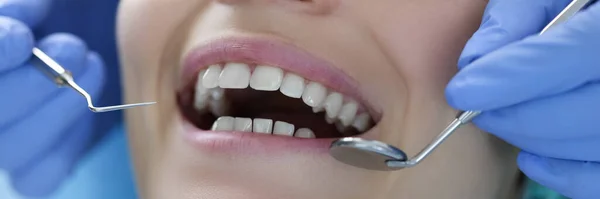 Οδοντίατρος με ατσάλινα εργαλεία στα χέρια του εξετάζει ασθενείς δόντια closeup — Φωτογραφία Αρχείου