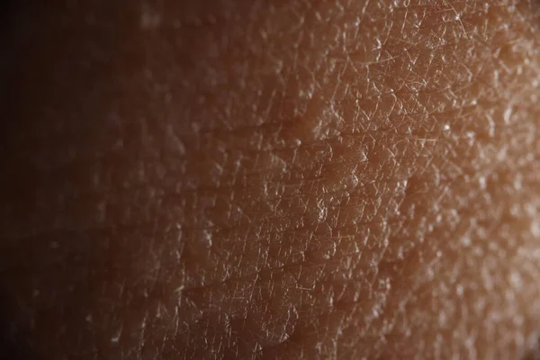 Human skin with small hair close up. — Stock Photo, Image