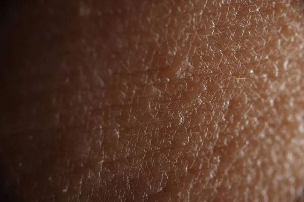 Piel humana con pelo pequeño de cerca. —  Fotos de Stock