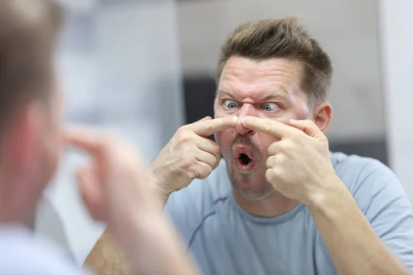 Joven se mira en el espejo y presiona espinillas en su nariz —  Fotos de Stock