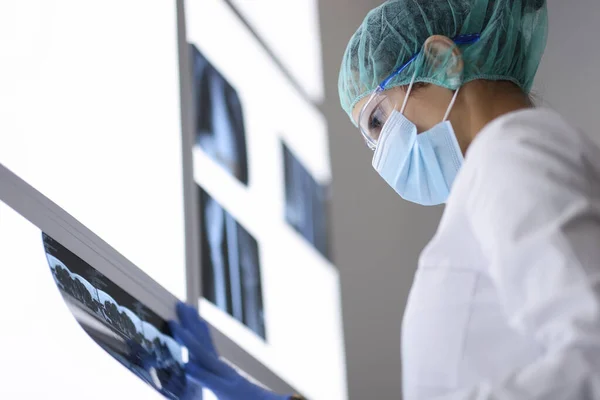 Doutor em máscara médica protetora e óculos olha para um raio-X. — Fotografia de Stock