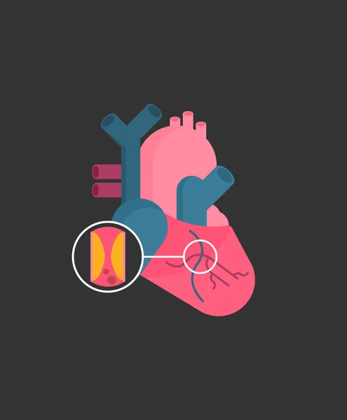 Ανατομική Καρδιά Σχεδιασμός Επίπεδου Στυλ Διάνυσμα — Διανυσματικό Αρχείο
