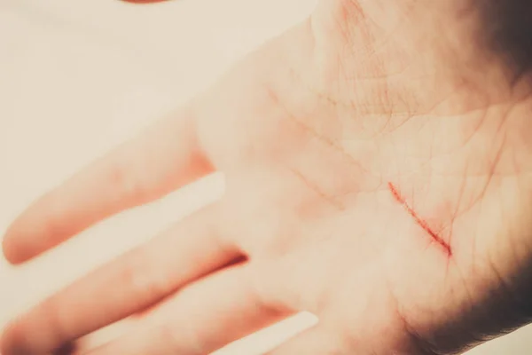 Woman palm with a red fresh cut scratch on a destiny line. close up