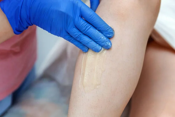 Beautician Makes Epilation Close Girl Her Leg Shugaring — Stock Photo, Image