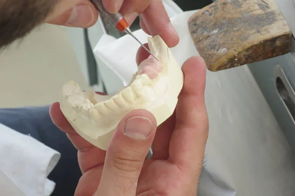 Construção Laboratório Odontológico Impressões Dentárias — Fotografia de Stock