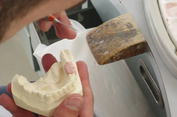 Construção Laboratório Odontológico Impressões Dentárias — Fotografia de Stock