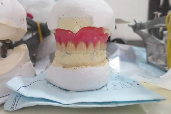 equipment and tentative impressions in the dental clinic of a dental technician