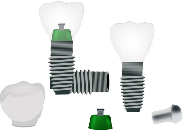 Dental prosthesis dental practice implant — Stock Vector
