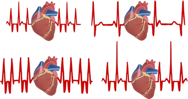 Cardiogram sports medicine to the heart heartbeat — Stock Vector