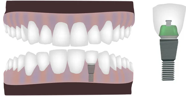 Tandtechnicus tandheelkundige instrument reconstructie — Stockvector