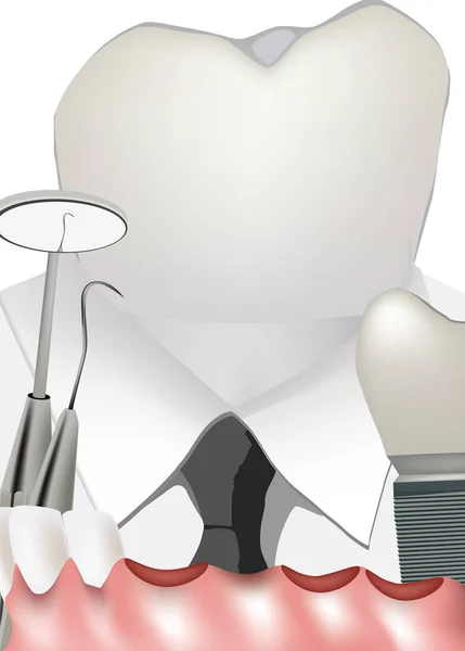 Técnico dental reconstrucción de instrumentos dentales — Vector de stock