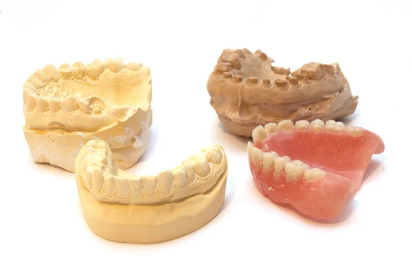 Diş Implantı Kalıpları Için Diş Alçıtaşı Izleri — Stok fotoğraf