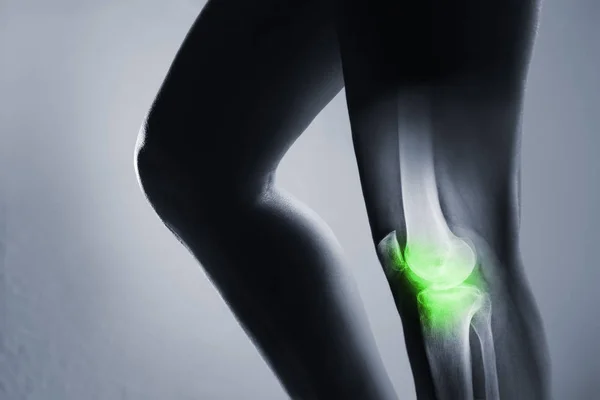 Articulación de rodilla humana y pierna en rayos X, sobre fondo gris. —  Fotos de Stock