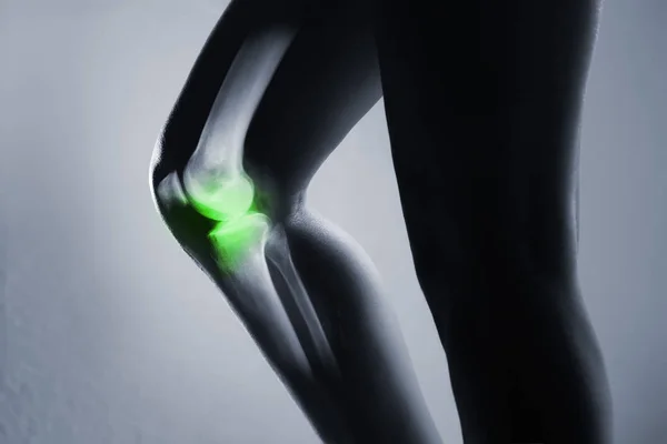 Людський колінний суглоб і нога в рентгенівському діапазоні, на сірому фоні . — стокове фото