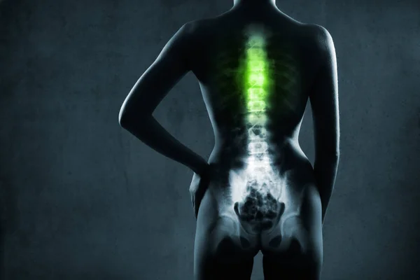 Menselijke wervelkolom in x-ray, op grijze achtergrond — Stockfoto