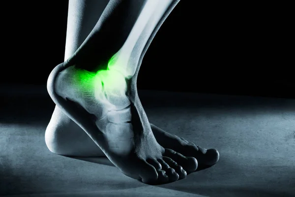 Pie humano tobillo y pierna en rayos X, sobre fondo gris —  Fotos de Stock