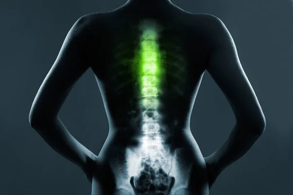 Human spine in x-ray, on gray background — Stock Photo, Image