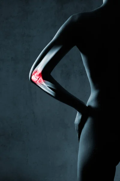 Локтевой сустав человека в рентгене, на сером фоне — стоковое фото