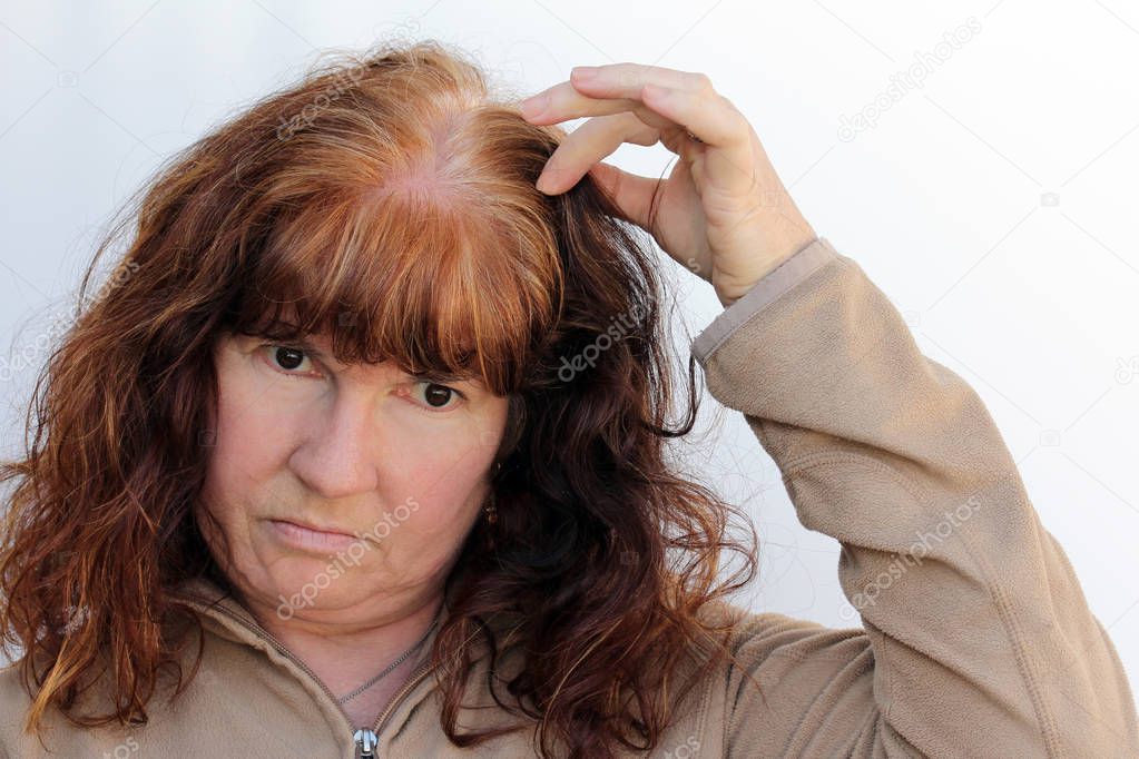 A woman has problems with hair loss and a sensitive scalp. Menopausal hair loss