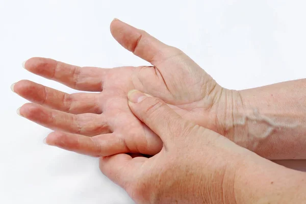 女性は手に痛みがあり 指は乾燥した肌に苦しんでいます — ストック写真