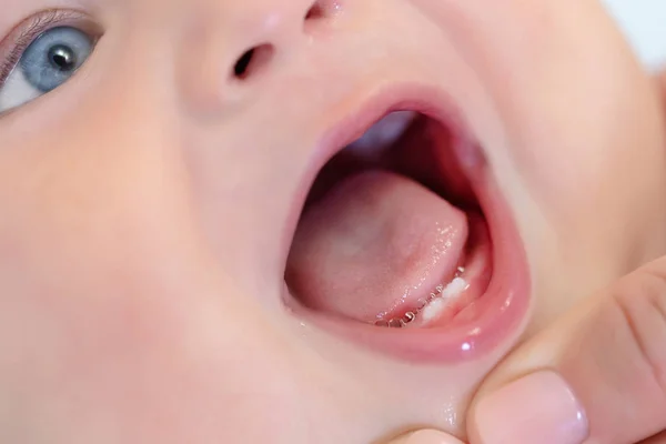 Matka noworodek otwarte usta, aby zbadać pierwsze zęby. Niemowlę podstawowy uzębienia. Opieki zdrowotnej dzieci i uzębieniem wewnętrznym koncepcja — Zdjęcie stockowe