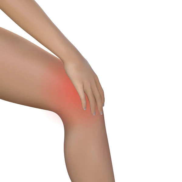 Jovem mulher massajando seu joelho doloroso. Menina jovem ou mulher segurando o joelho por causa da dor intensa 3d vetor realista . — Vetor de Stock