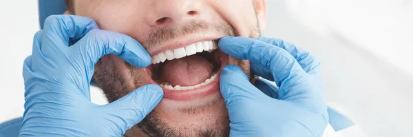 Homem com dentes examinados em dentistas — Fotografia de Stock