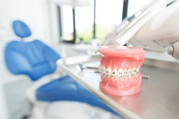 протез зубний