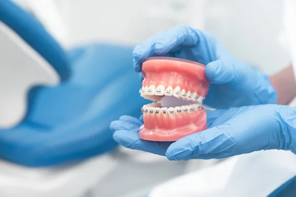 Dentista sosteniendo modelo de mandíbula, concepto de ortodoncia — Foto de Stock