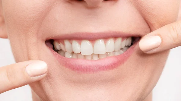 Sorrindo mulher boca com dentes brancos — Fotografia de Stock