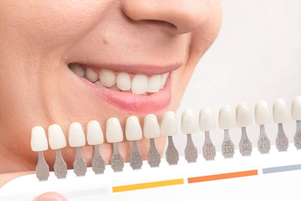 Uśmiech kobiety ze zdrowymi zębami wybielania — Zdjęcie stockowe