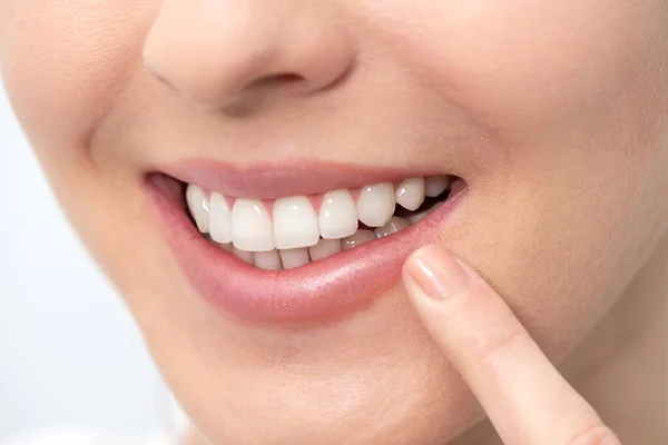Mujer Mostrando Una Sonrisa Perfecta Blanqueamiento Dental Concepto Cuidado Dental — Foto de Stock