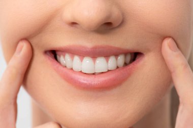 Mükemmel bir gülümseme gösteren kadın. Diş beyazlatma, diş bakımı konsepti