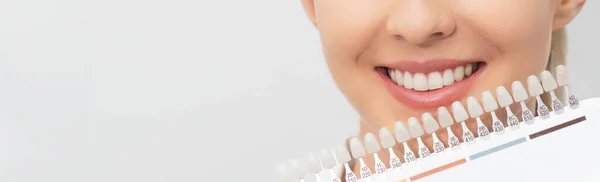 歯のホワイトニングプロセス トーンの様々な色合いのインプラントのセット 歯科治療 — ストック写真