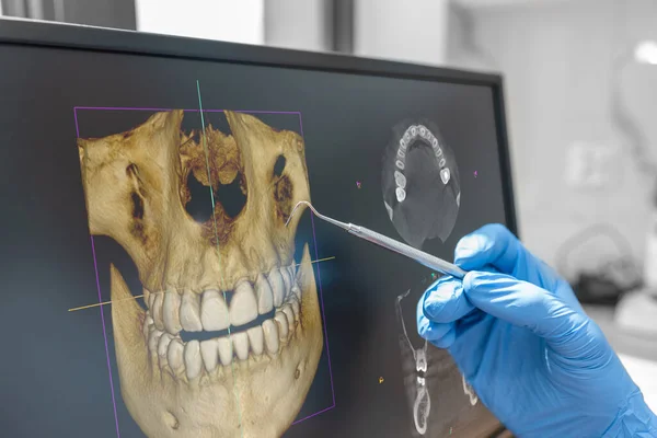 診療所で歯科相談 画面上の3D断層撮影画像を示す歯科医 — ストック写真