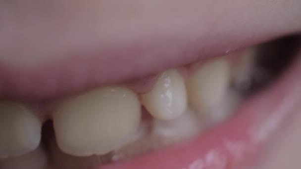 Bambino con un dente allentato — Video Stock